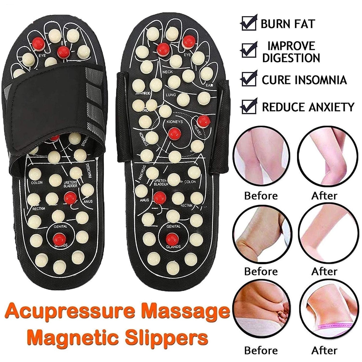 🩴67% OFF NOW! 🔥Acupressure and Magnetic Therapy Slippers 🦶🔥