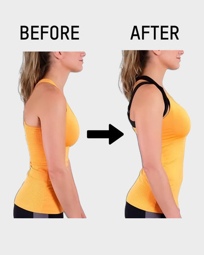 ⏳LAST DAY SALE ONLY 8.99!!👍✨Cross Back Front Closure Wireless Posture Support Bra– All-Day Comfort, Breathable & Summer-Ready 💕