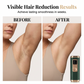 💖Last Day Sale 49% OFF💖Professional IPL Laser Hair Removal Device